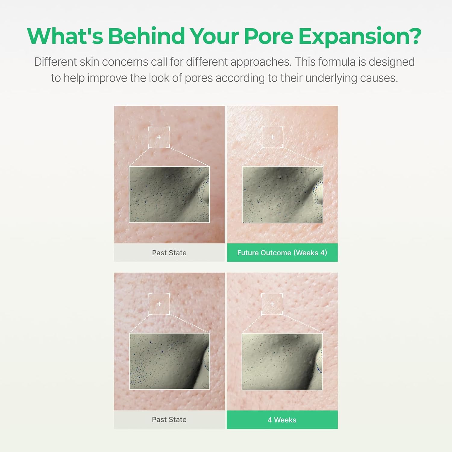 Zinc Witch Hazel Infusion Serum,Pore Tightening, Shine Control, For Oily & Acne Prone Skin,30ml,Korean Skincare