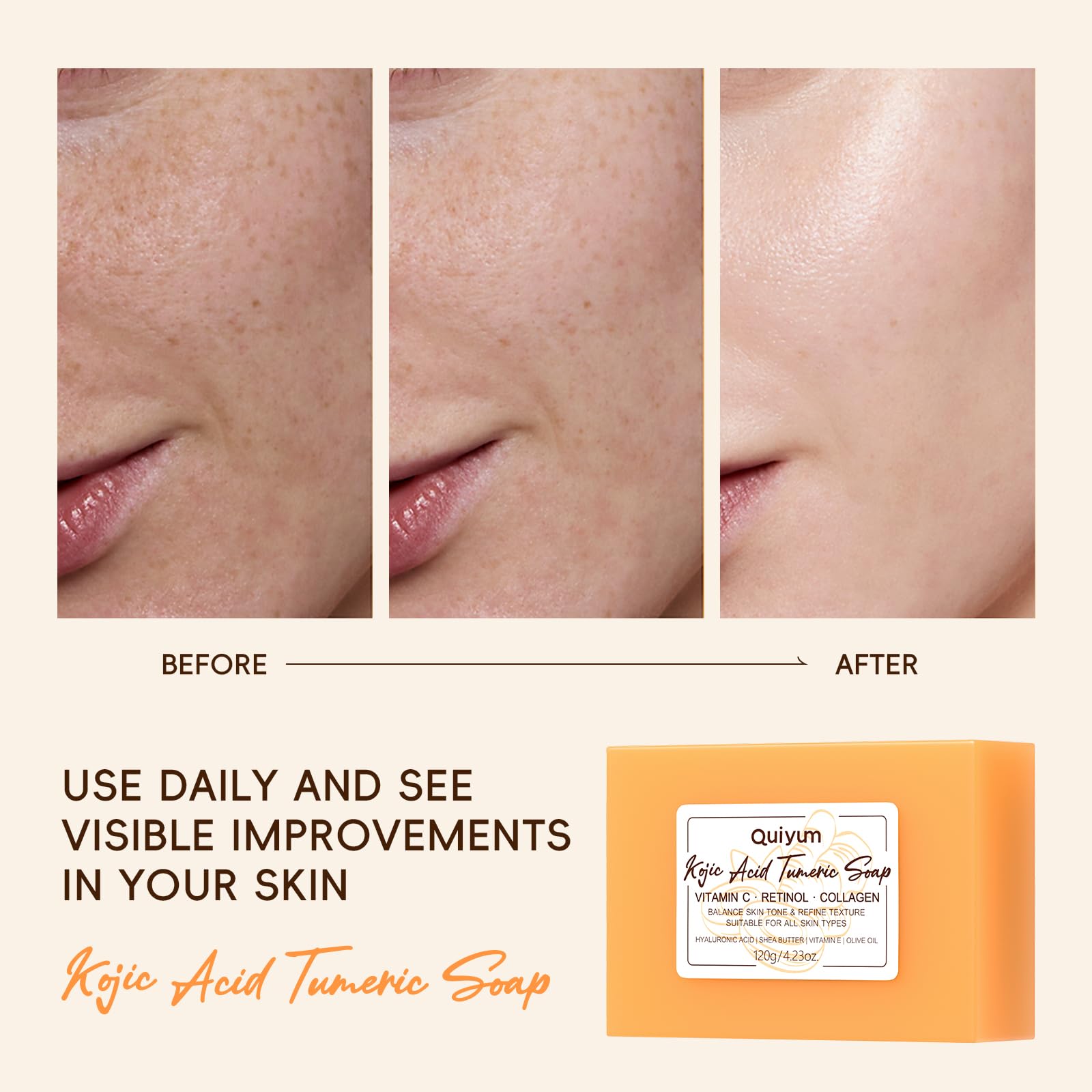 Quiyum Kojic Acid & Turmeric Soap Bar (3x120g), Face & Body Cleanser with Vitamin C, Retinol - Image 4