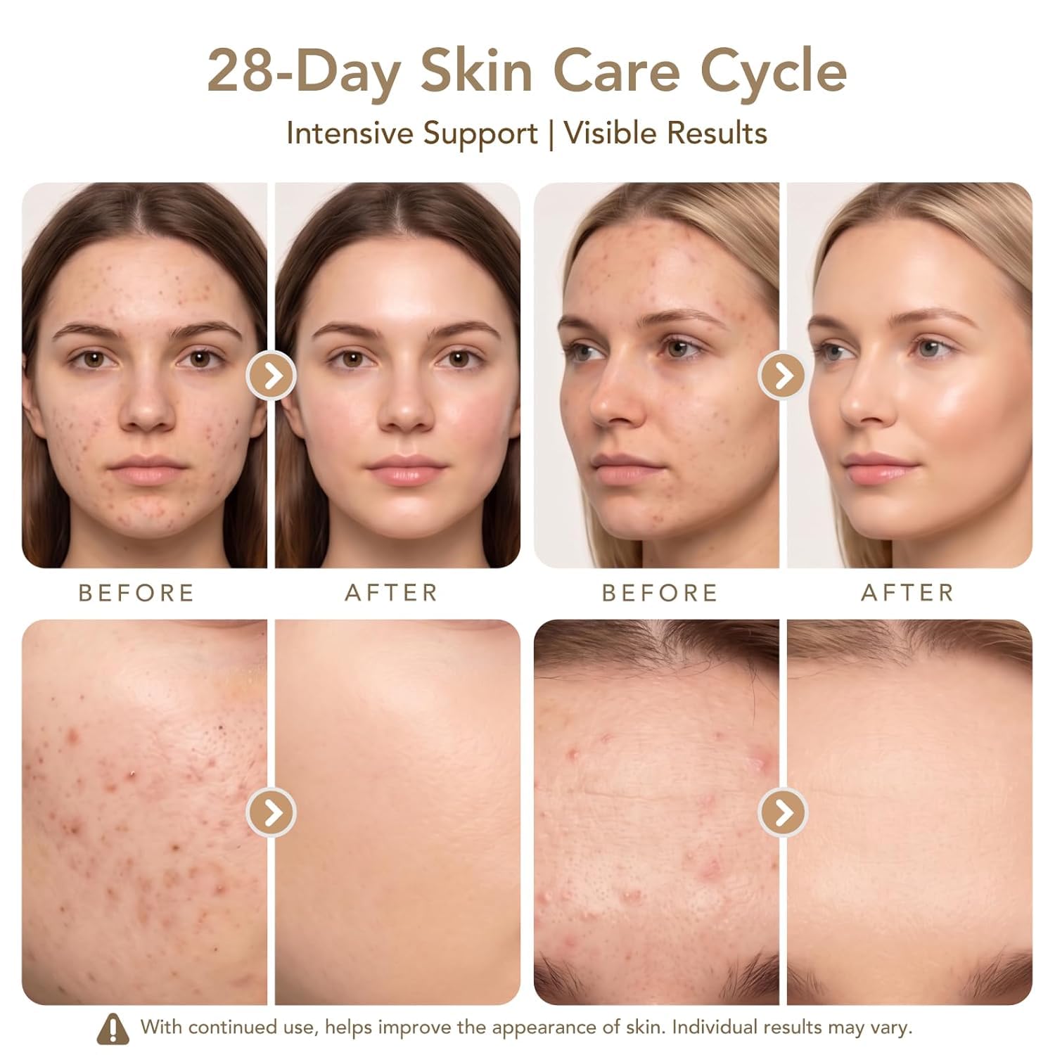 Dr. Pen Cartucce 12 Pin, 15 Pezzi, Cartucce di Ricambio per Penna Microneedling, per la Cura Mirata della Pelle, Compatibili con M8S/A8S/A9