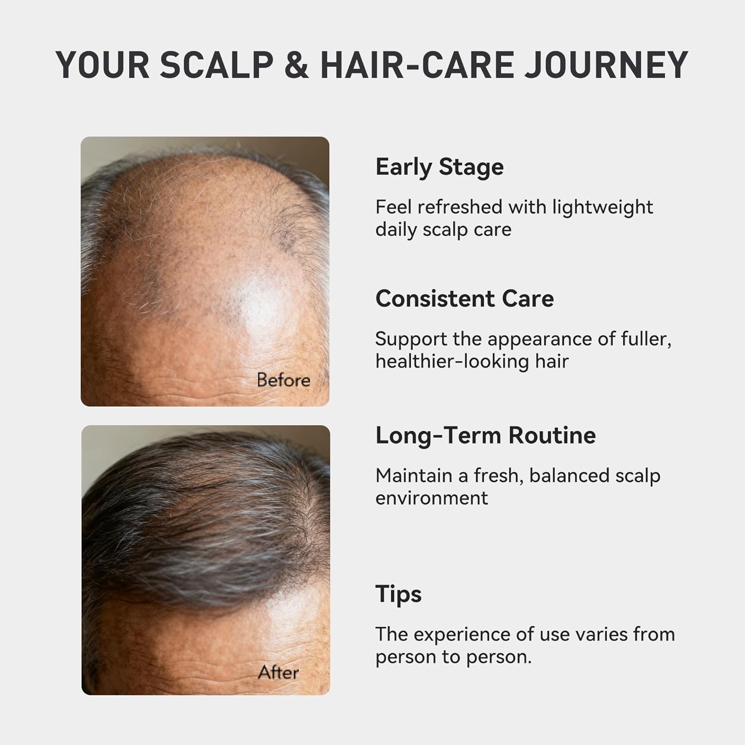 0.9% KX-826 KINTOR Hair Growth Spray for Men, DHT Blocker Hair Regrowth Products to Nourish Hair Follicles, Oil Control and Thick Hair Roots, Pro Version, 60ml