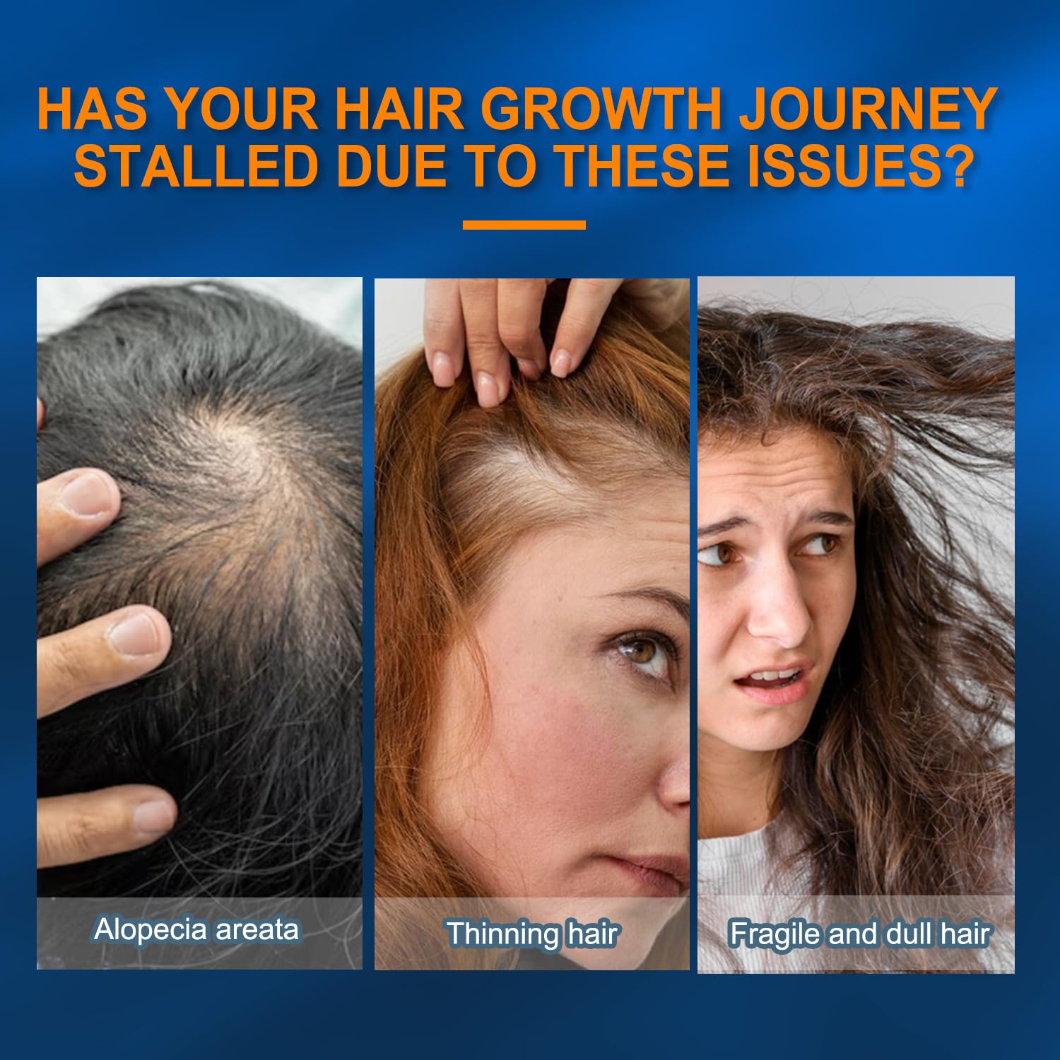 Minoxidil Hair Serum spray for Men and Women, 5% Minoxidil Hair Serum，promotes hair growth, makes hair and beard thicker and fuller (60ml)