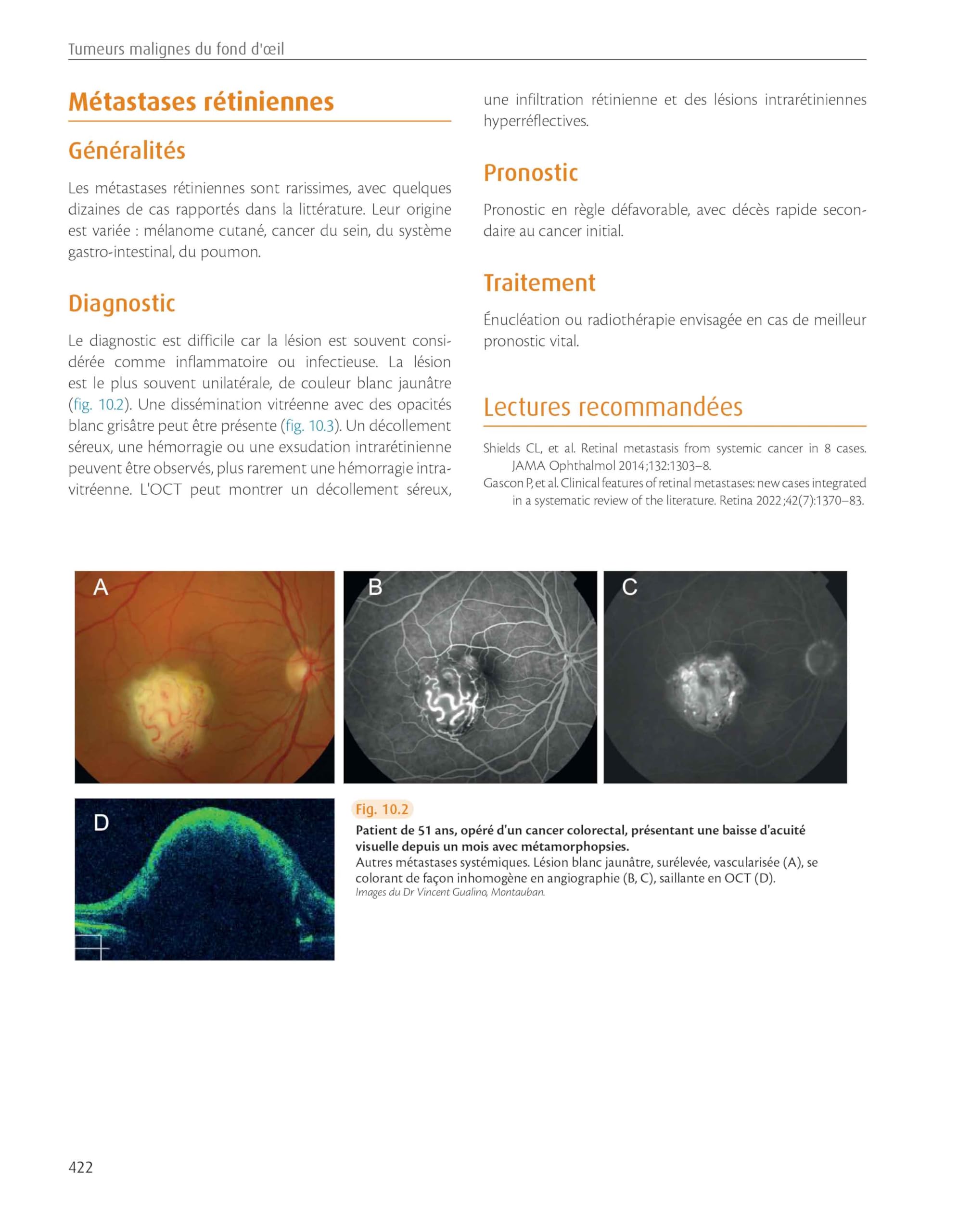 Rétine : atlas des maladies du fond d'oeil