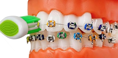 Miniatura 4 de Braces - Cepillo de dientes ortodóntico de cerdas suaves para limpieza de ortodoncia | Cepillos de dientes portátiles en forma de U para aparatos
