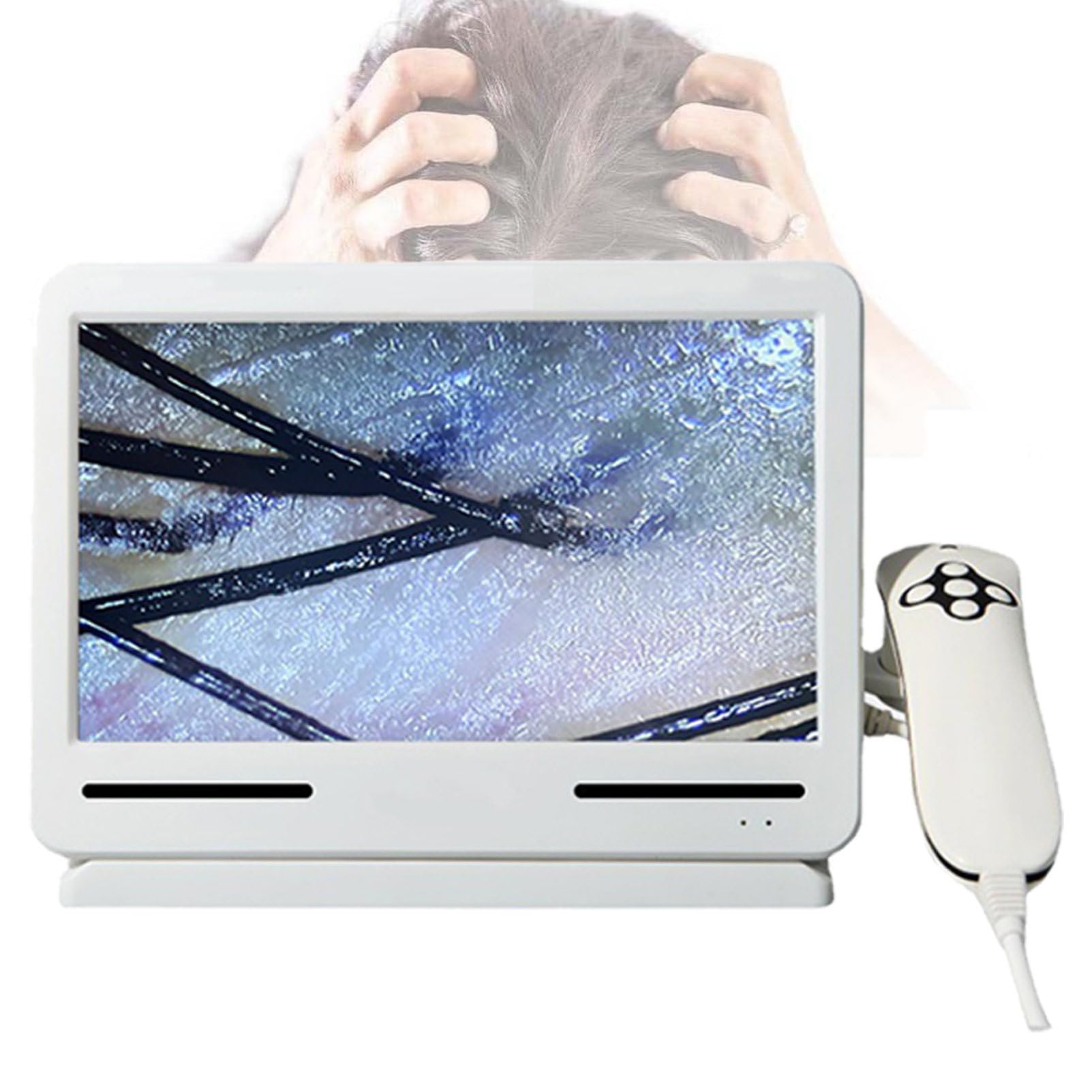 Analizador De Cabello para DiagnóStico De Piel, Detector De Cuero Cabelludo De 10,1 Pulgadas, Microscopio Capilar, EscáNer De AnáLisis De Analizador De Cabello