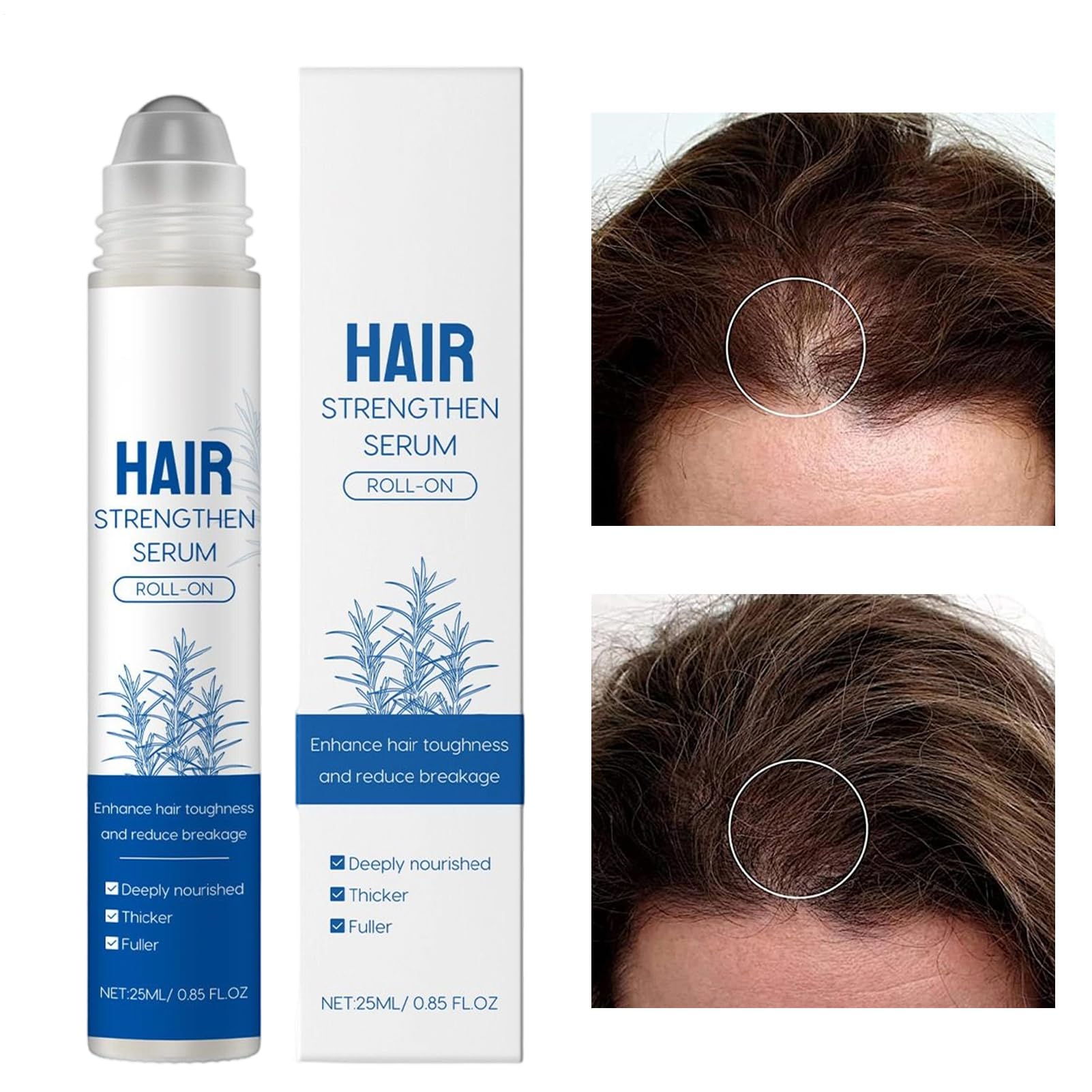 Rouleau de croissance des cheveux - 25 ml - Stylo nourrissant qui ne pousse pas les cheveux - Sérum de croissance des cheveux scalpiques - Solution de rouleau de soin du cuir chevelu pour cheveux