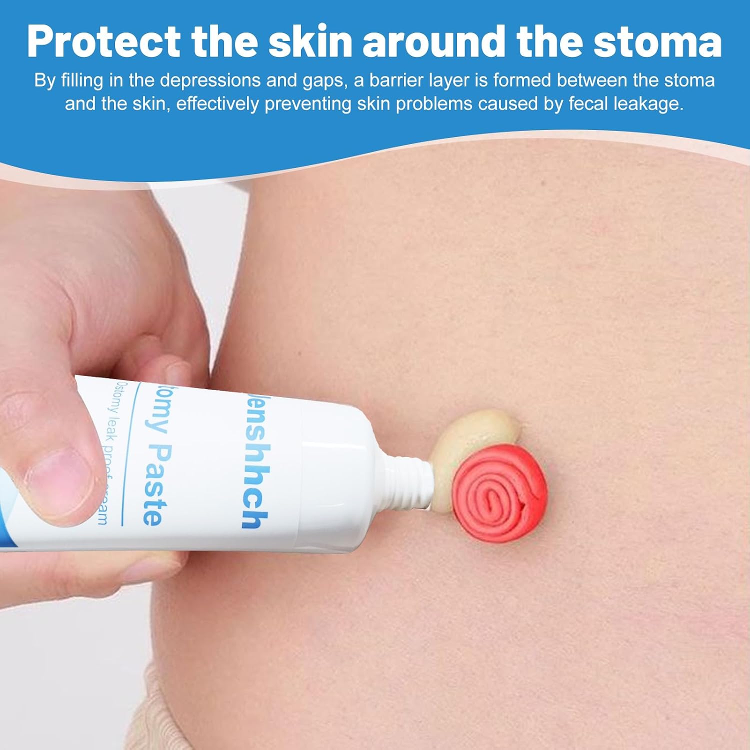 Ostomy Paste Ostomy Supplies, 6 oz Colostomy Skin Barrier Paste