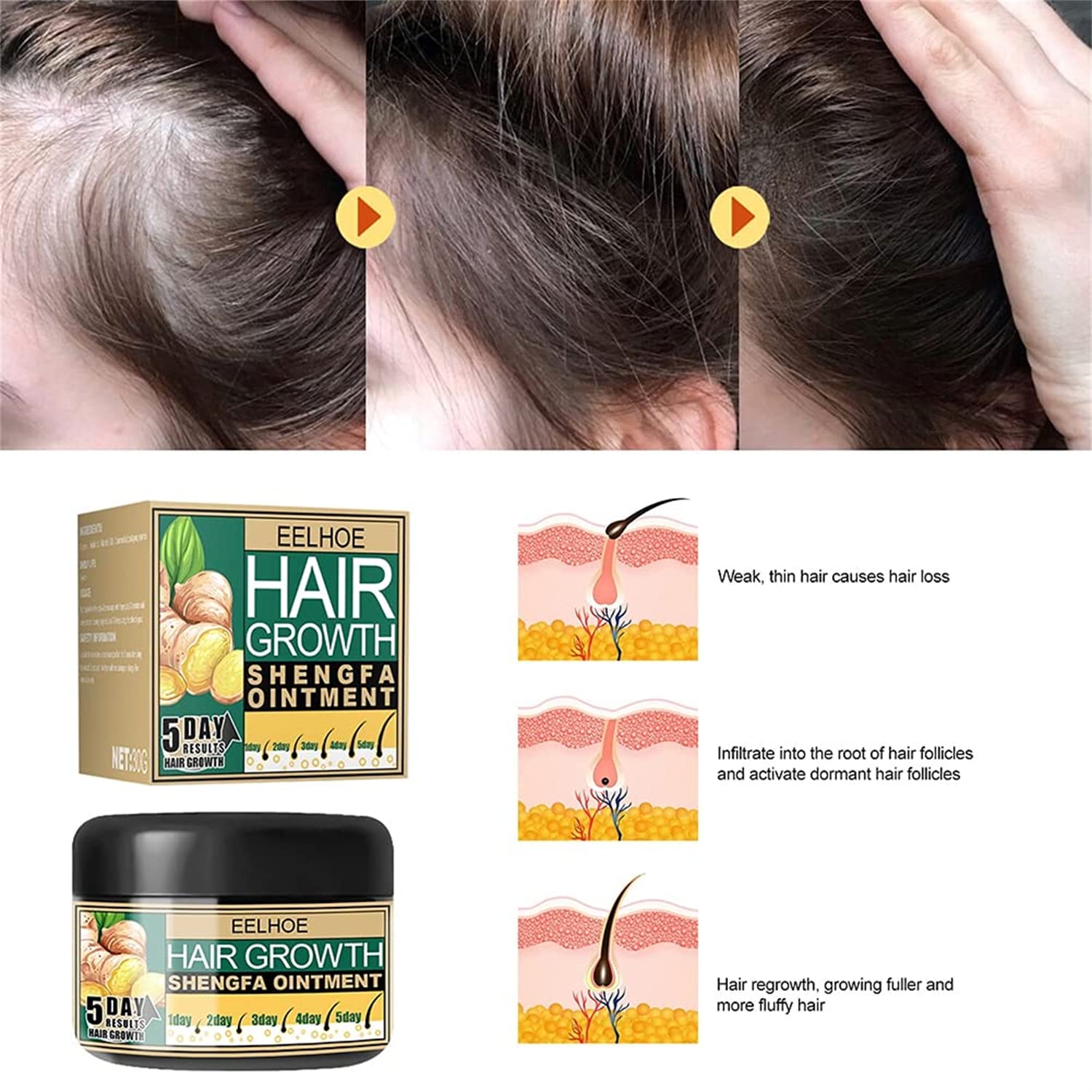 Amazon｜ヘアブーストジンジャークリーム、ジンジャーヘアグロース軟膏
