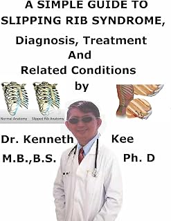 A Simple Guide To Slipping Rib Syndrome, Diagnosis, Treatment And Related Conditions