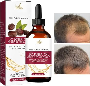 Hair Growth Oil | Jojoba Oil Anti-frizz Hair Density Oil For Hair Growth | Natural Hair Regrowth Oil With Wild Hair Growth Oil 30ml For Women & Men190/200
