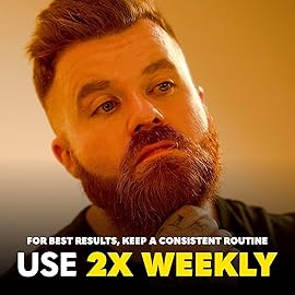 The Beard Club Derma Roller for Face, Body and Scalp - Microneedling for Men and Women with 540 Titanium Microneedles - Beard Roller & Micro Needling Scalp Hair - Gray & Black