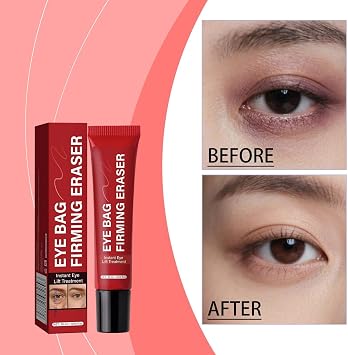 Eye Bag Instant Eraser, Anti-Aging Cream, EyeBags Remover Women, eye Bag Firming Eraser, Reduces Wrinkles & Puffiness, Soothing Moisture & Refresh for Eye Area,Suitable for All Skin Types (2PCS, 20g)