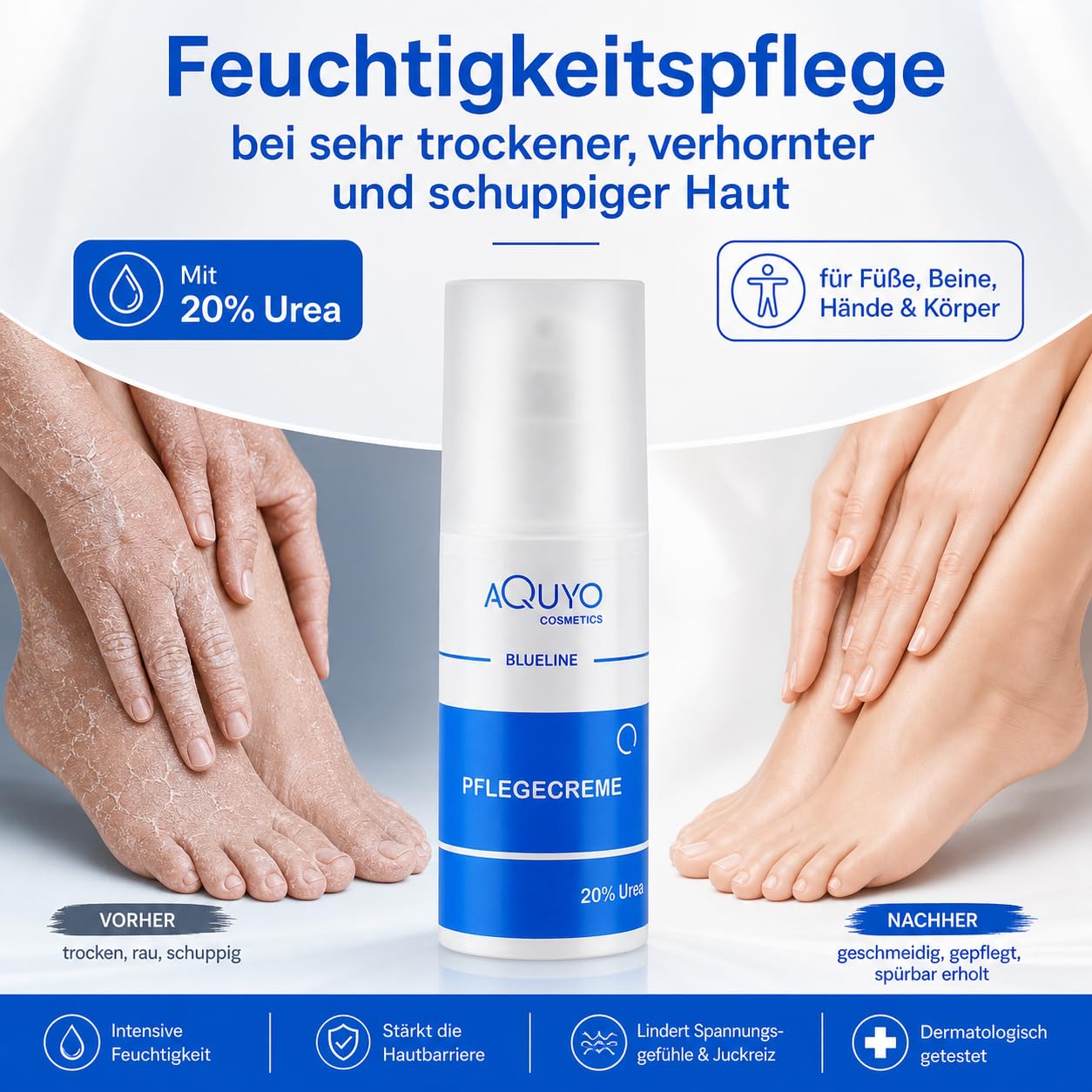 Blueline 20% Urea Creme, Schrundencreme für sehr trockene und verhornte Haut, Pflegecreme bei Schuppenflechte und Neurodermitis, Hornhaut erweicher und Hornhautentferner (100ml)