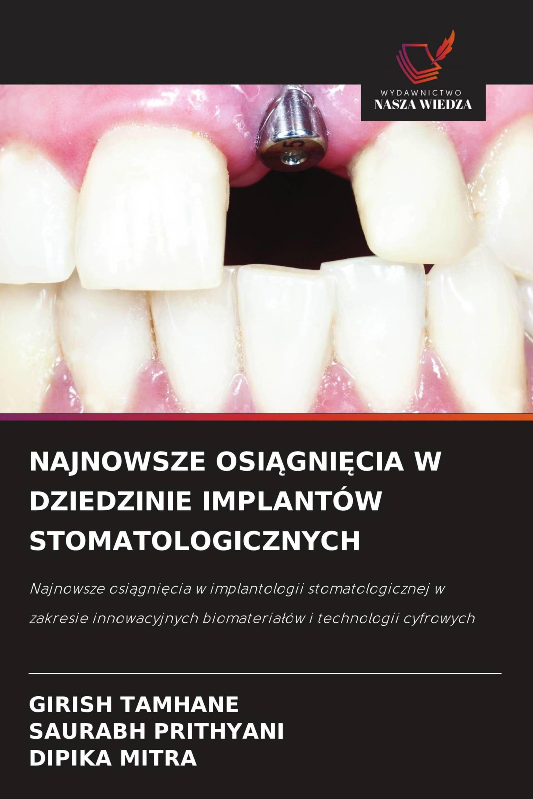 NAJNOWSZE OSI¿GNI¿CIA W DZIEDZINIE IMPLANTÓW STOMATOLOGICZNYCH: Najnowsze osi¿gni¿cia w implantologii stomatologicznej w zakresie innowacyjnych biomateria¿ów i technologii cyfrowych