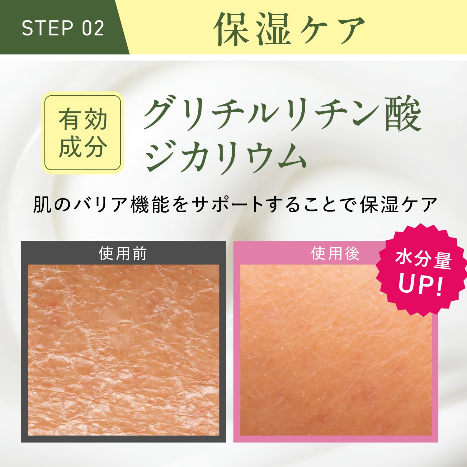 Amazon.co.jp: 二の腕 ぶつぶつ 首 背中ニキビ お尻 ボディスクラブ