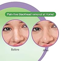 Vista 7 de DR.RASHEL Tiras de poros de nariz de árbol de té para limpieza de poros, eliminación instantánea e indolora de puntos negros Tiras eliminadoras