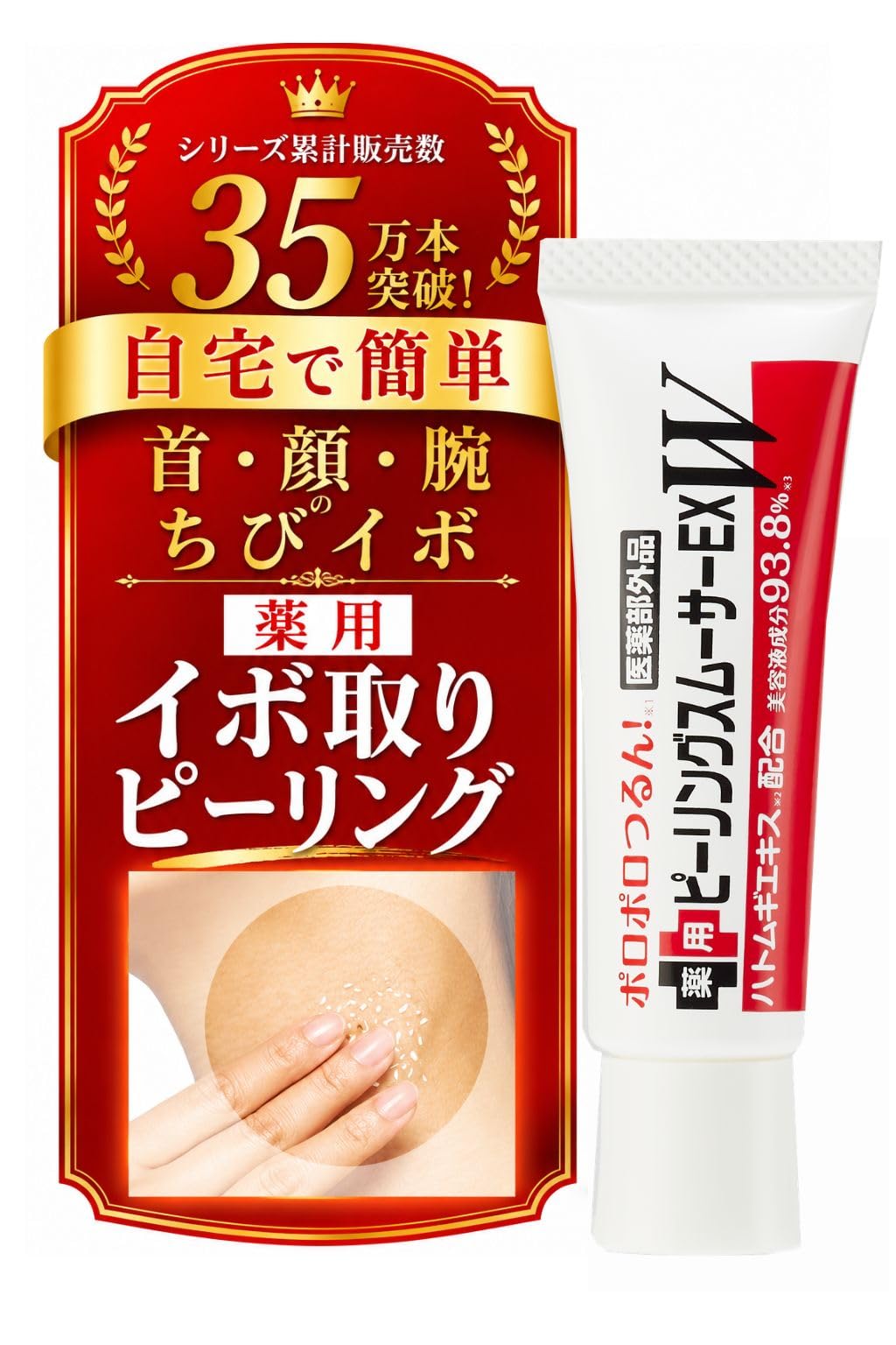 シーヴァ薬用イボ取りピーリングEXW15gでツルツル肌へ