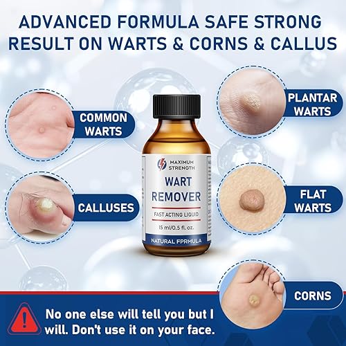 Miniatura 3 de SKAYAH Removedor de verrugas, tratamiento a base de plantas de acción rápida de 0.5 fl oz, removedor de verrugas sin dolor para maíz, verrugas H,