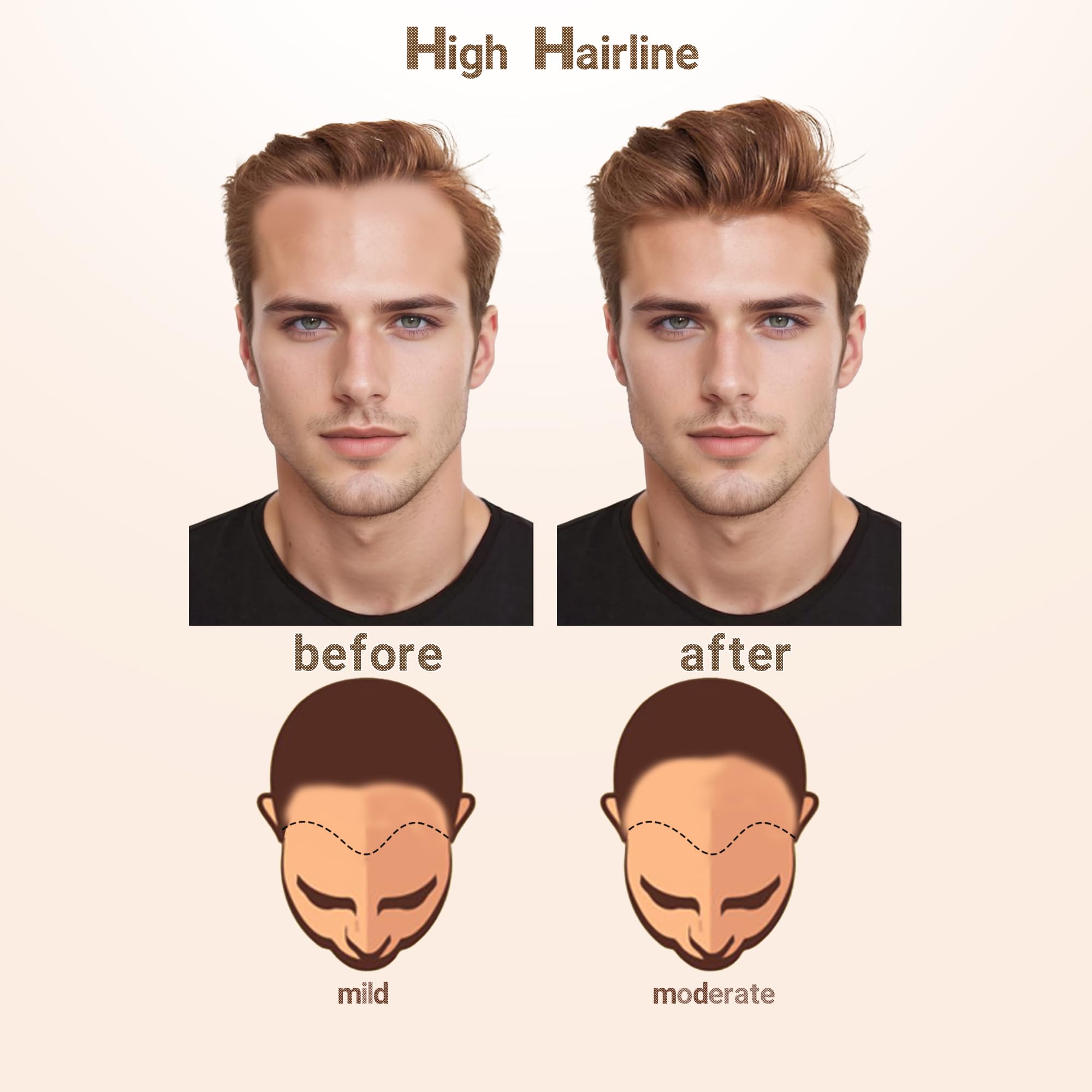 Human Hair Topper Straight Tape On V Shape Hairline Hair Extension V-Part Wig | Natural Straight V-Shaped Wig for Women main image 2