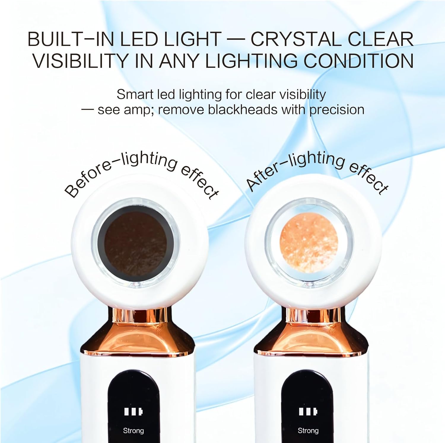 5X LED Blackhead Remover Vacuum | 3 Tips + 4 Acne Needles | USB-C
