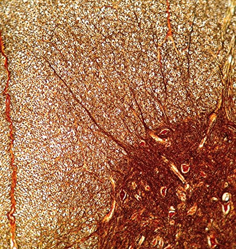 Idu Optics Labcam Microscope Adapter For Iphone 6/6S #TOP2