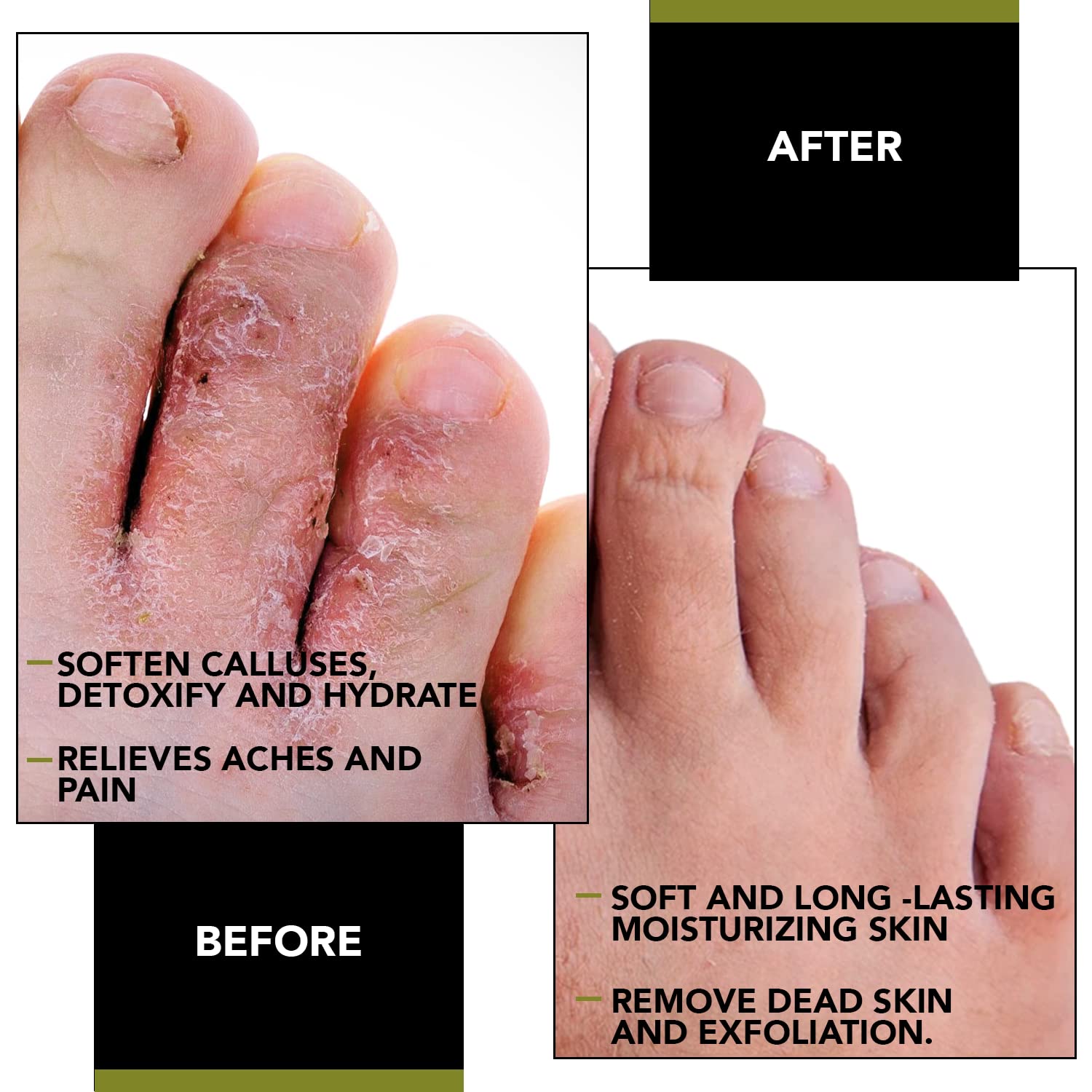 FungusLess Nail and Foot Purifier - Purify, Protect, and Rejuvenate Your Feet - Prevent Bacteria, Athlete's Foot, and Fungus - Image 2
