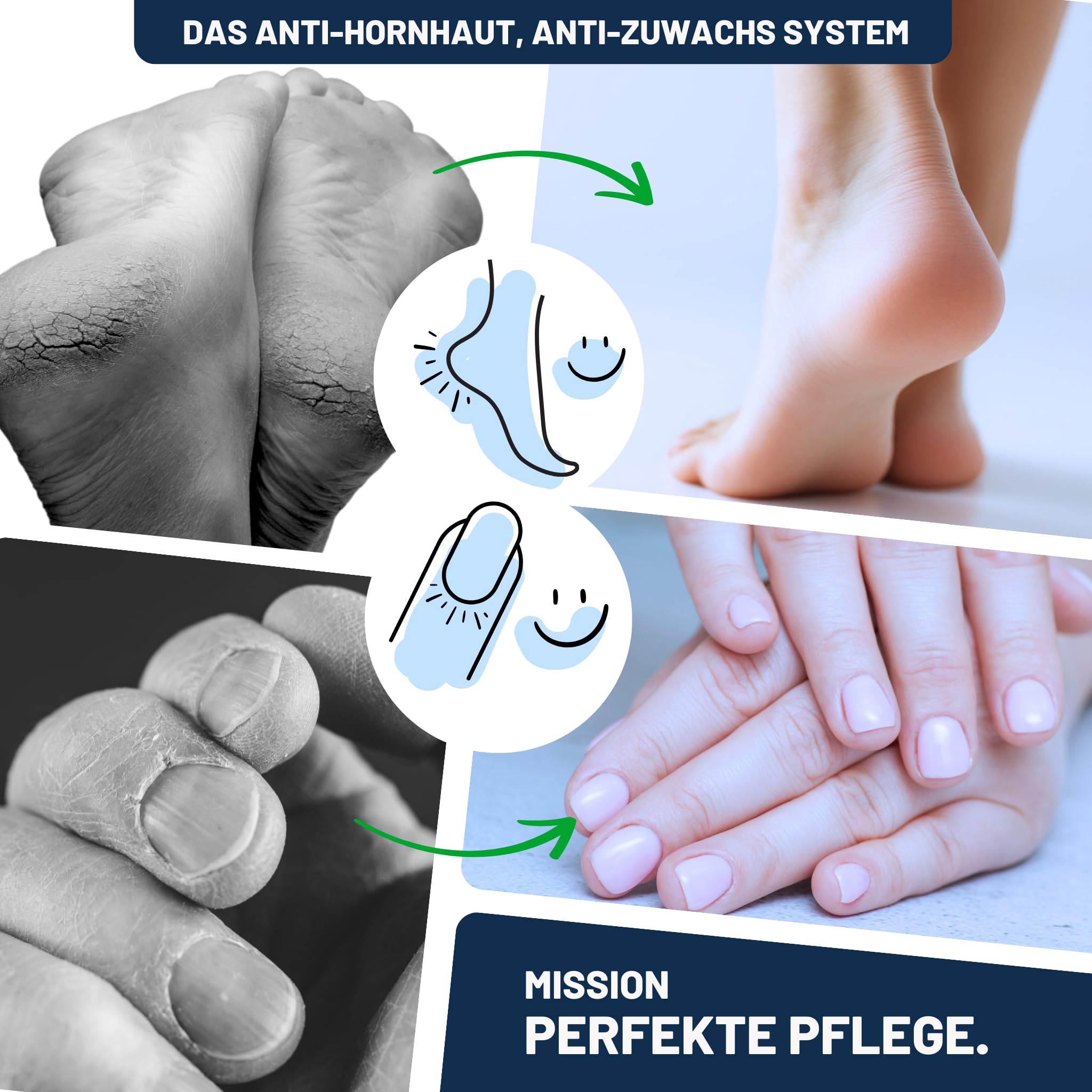 Mr. Fuss® System zapobiegający powstawaniu zrogowaciałego naskórka, środek do usuwania zrogowaciałego naskórka, roztwór nr 1, silnie zmiękczający, 200 ml