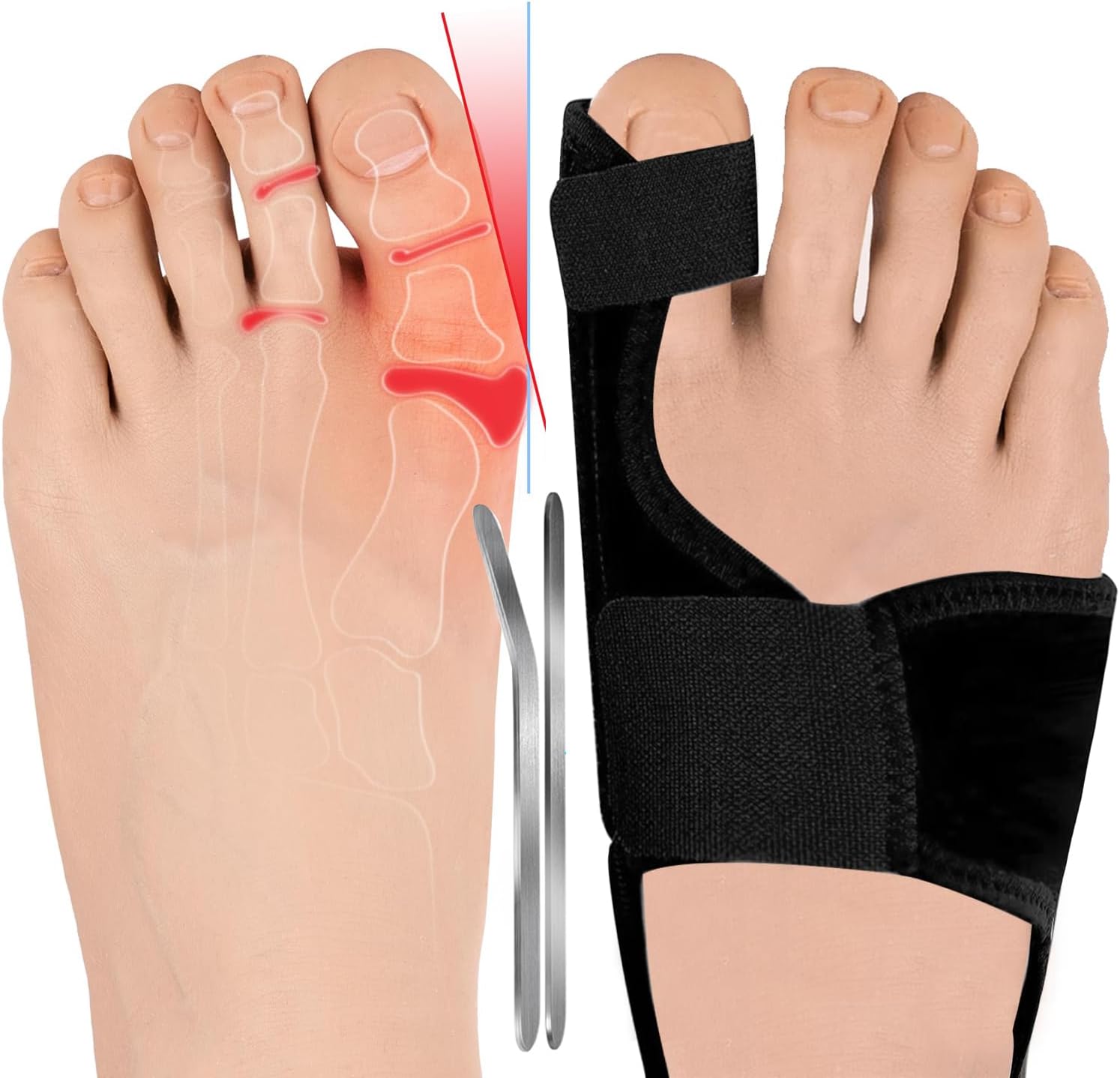 LINXIUBunion Corrector for Women Men Big Toe Straightener Adjustable Bunion Splint Brace Hallux Valgus Correction Orthopedic Sleeve for Day Night Support 2 Pcs