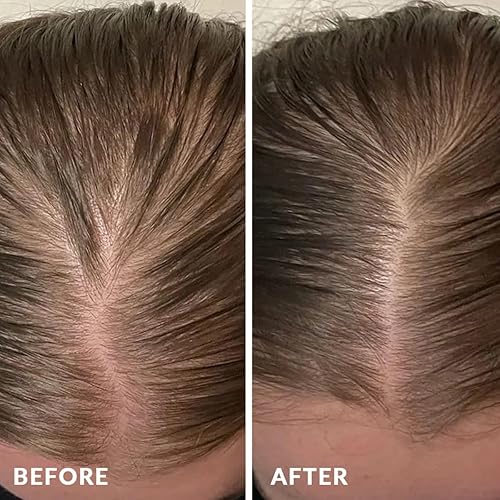 Miniatura 6 de PureNaturis Juego de tratamiento y sistema de reparación de agua de arroz de romero para el crecimiento del cabello, agua de arroz vegana sin