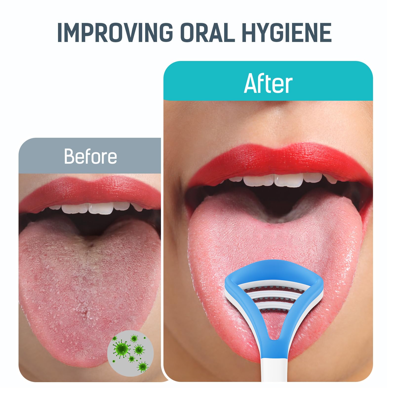 Morpilot Irrigador Bucal Dental Inalámbrico 3 Modos 5 Boquillas IPX7 300ML