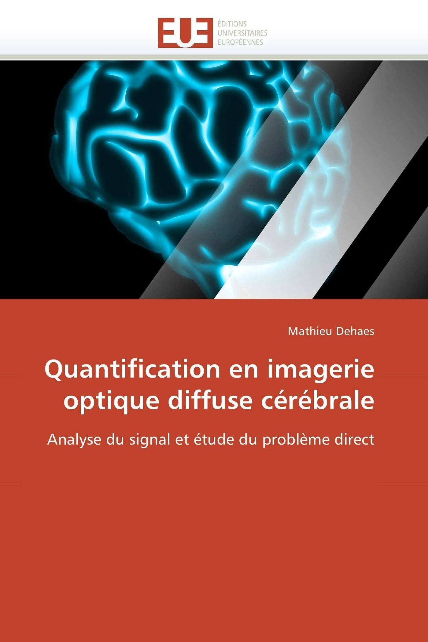 Quantification en imagerie optique diffuse cérébrale: Analyse du signal et étude du problème direct (Omn.Univ.Europ.)