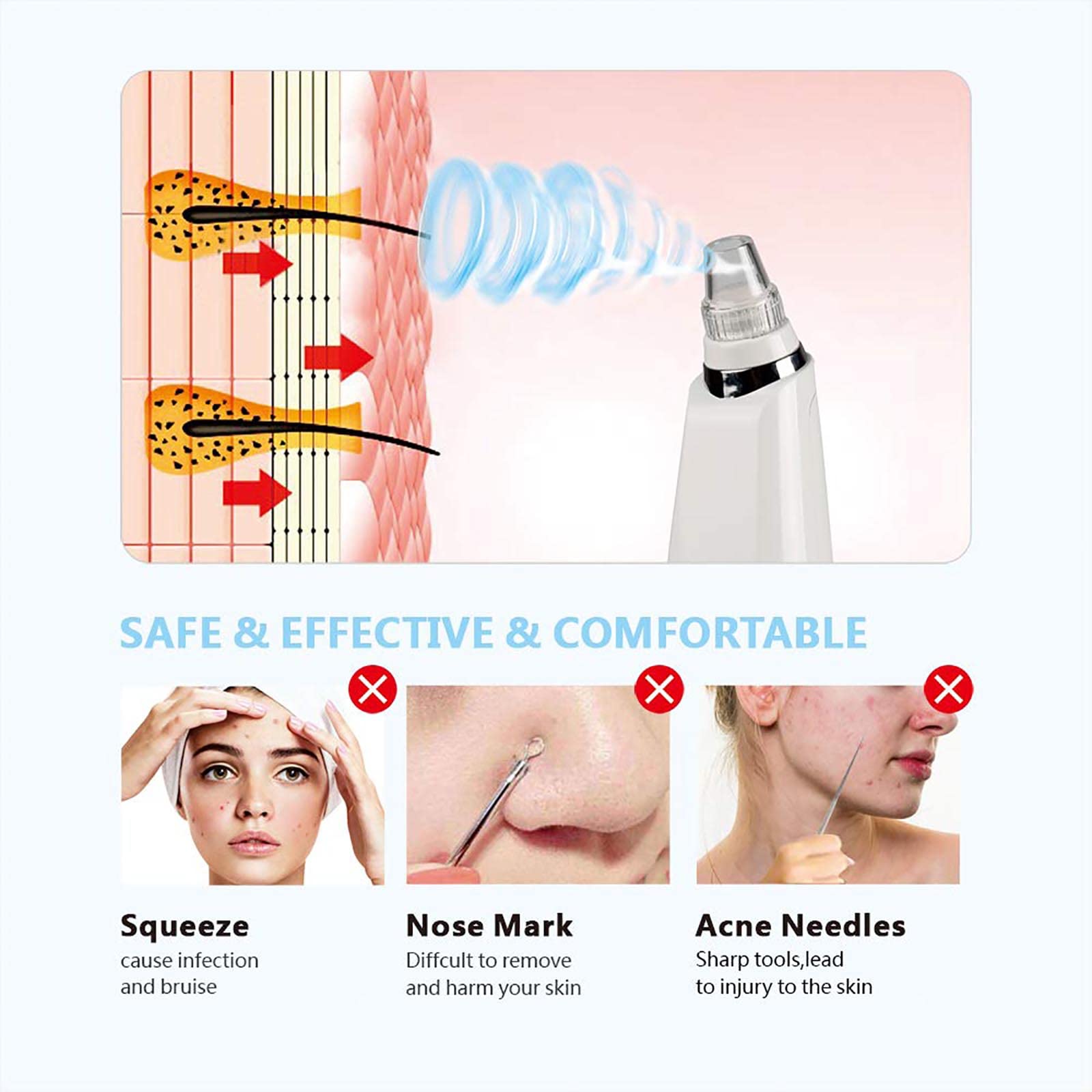 WolFum Kit de extractor de acné eléctrico – Herramienta de succión de puntos negros, herramienta de extracción de puntos blancos de comedones de acné, aspiradora de poros para eliminar puntos negros,