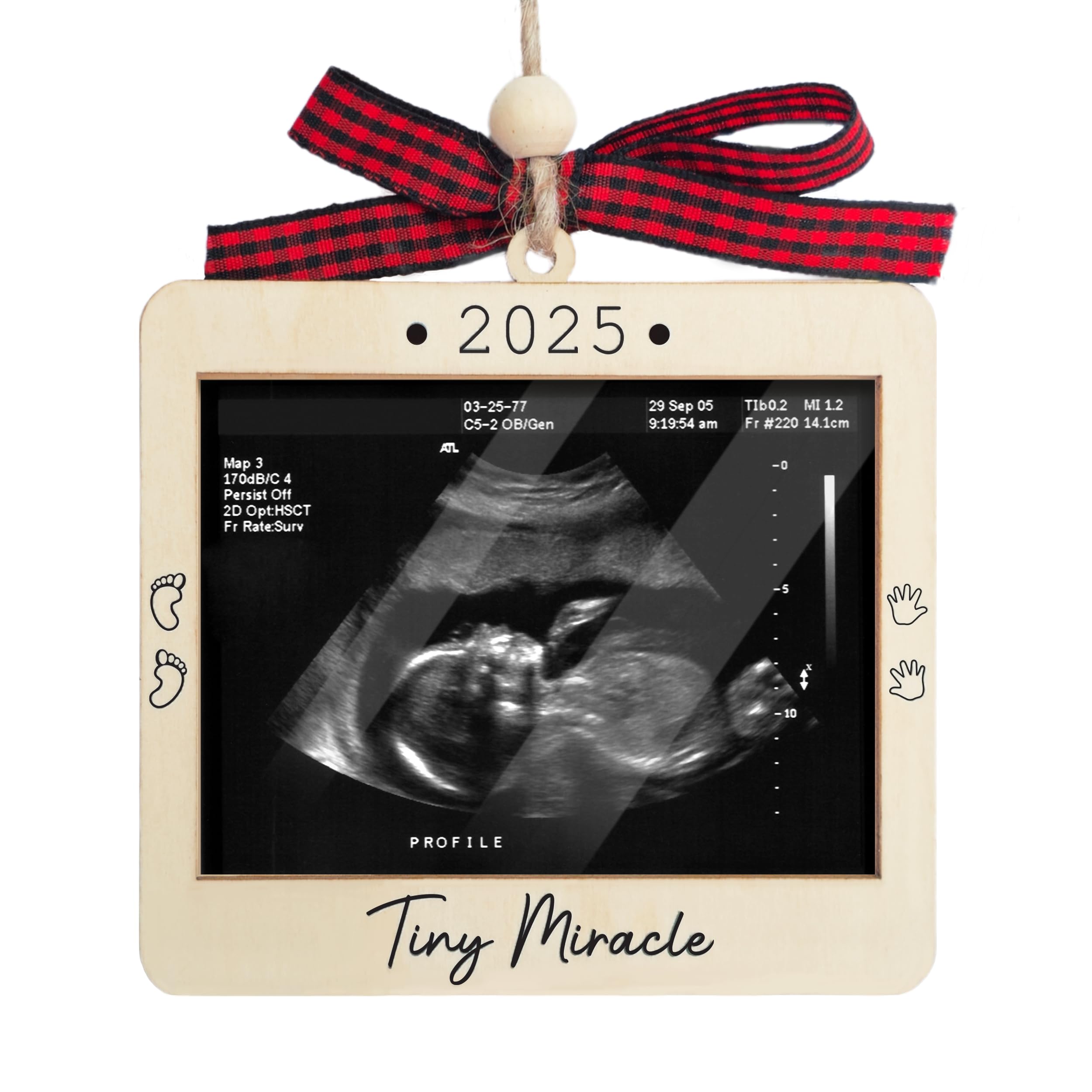 Ultrasound Picture Frame Ornament with Plastic Cover - Tiny Miracle Picture Frames - Baby Coming Soon Announcement for Grandparents, Husband -