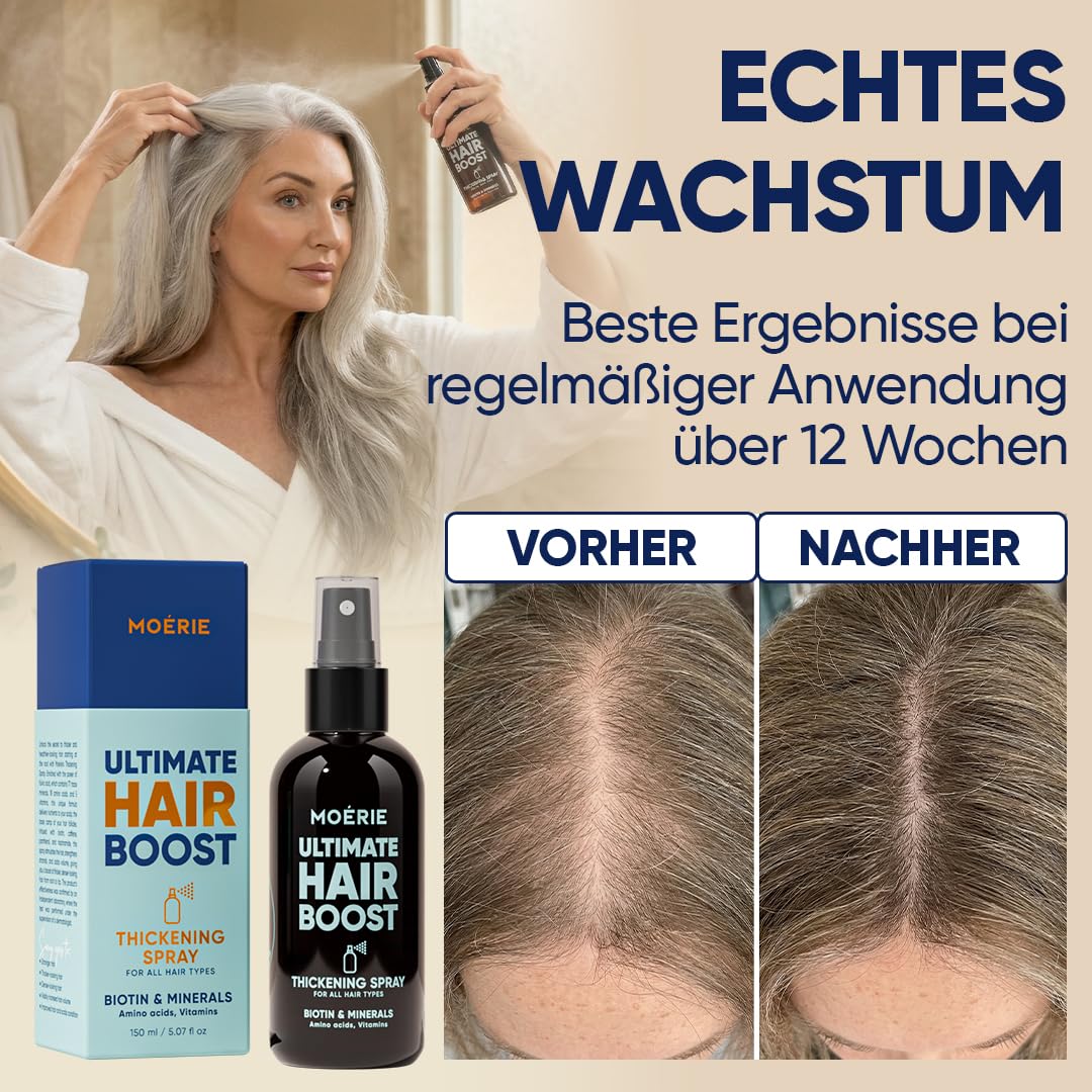 MOERIE Haarwachstum Serum Spray - natürlich Haarwachstum beschleunigen - Haarwuchsmittel Frauen & Männer - mit Mineralien, Caffein & Biotin Haare stärken - Haarvitamine gegen Haarausfall Frau