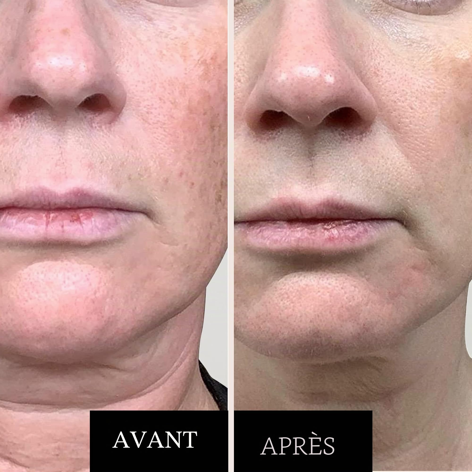 Pack Soin Visage : Crème au Rétinol et Sérum à la Vitamine C - Anti-Âge, Anti-Rides, Hydratant - Réduit les Taches, Éclaircit et Raffermit la Peau - Soins du Visage Professionnels
