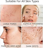 Vista 3 de Face Scrubber 2Pack Silicone Face Scrubber for Men, Facial Cleansing Brush Silicone Face Wash Brush Manual Waterproof Cleansing Skin Care Face