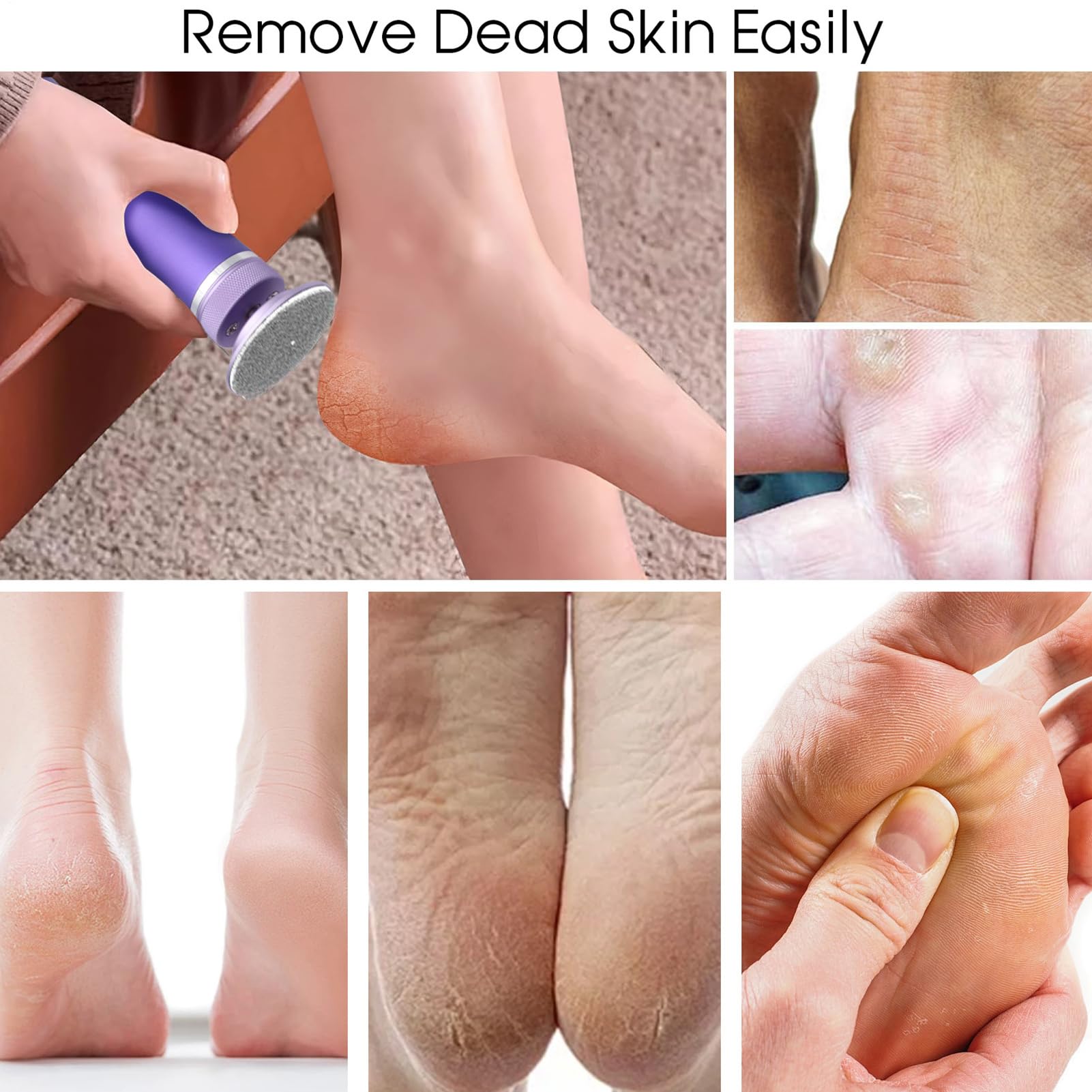 Lima Elettrica Per Piedi | Scrub Piedi Professionale - Levigatore Talloni Ricaricabile con 12 Velocità per Pelle Morta Pedicure Domestico Donne Anziani Sportivi e Cura Dei Piedi