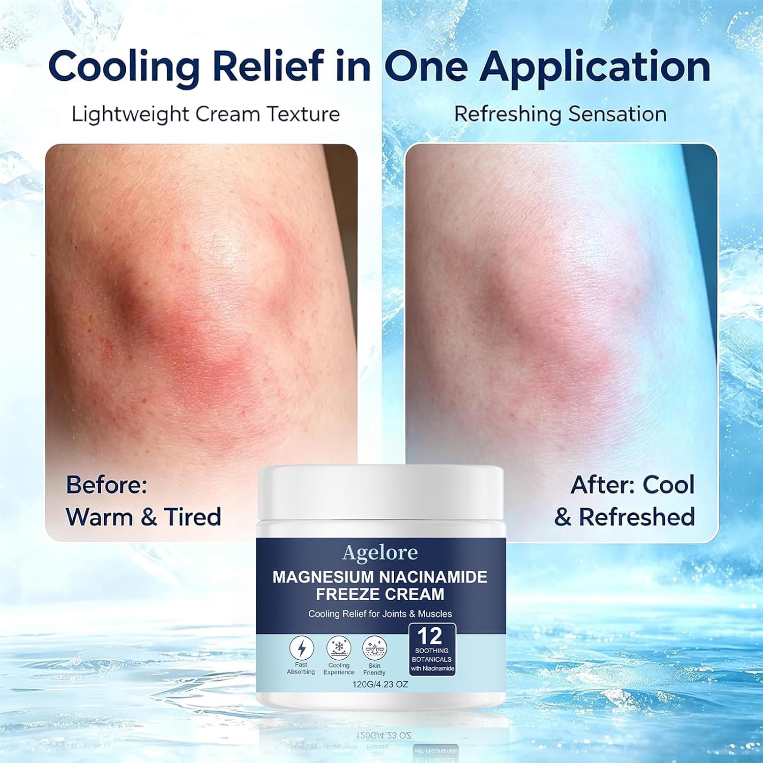 Agelore Magnesium Niacinamide Freeze Cream,Relieve pain,Cooling Formula