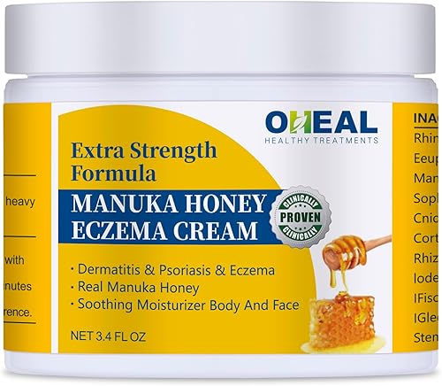 Crema de eccema de miel de Manuka, crema de eczema para adultos y adolescentes, crema de tratamiento de dermatitis, tratamiento de psoriasis para la