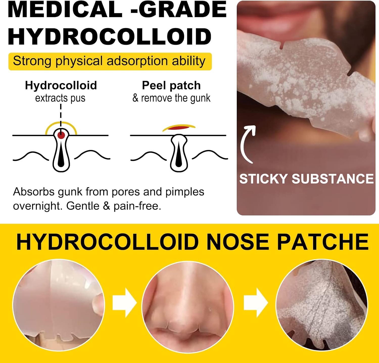 Nose Patch Cleansing Pore Strip for Nose Pores, Pimples, Zits and Oil