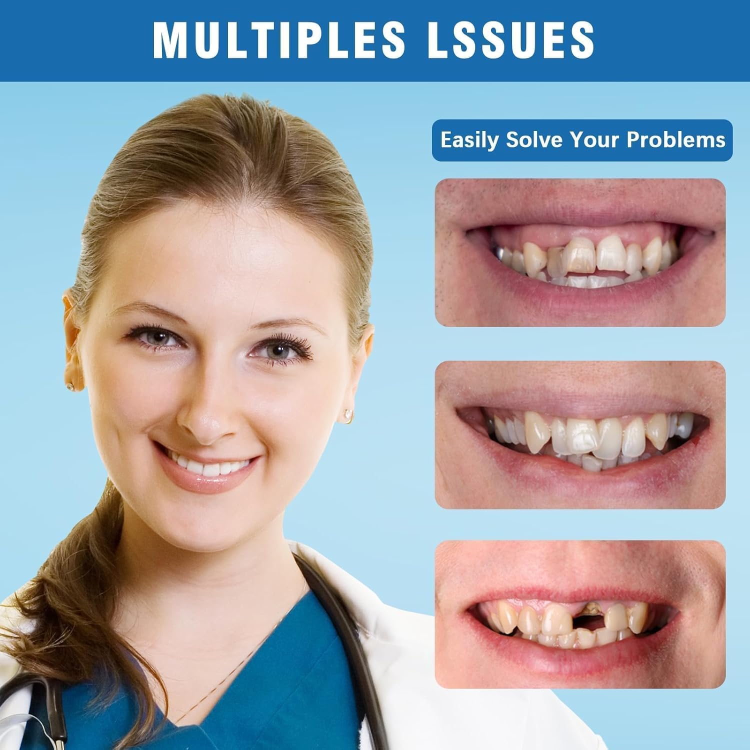 Moldable False Teeth - Silicone Dentures - Men and Veneers Teeth for Women - Upper and Lower Matching Set - Fix Your Smile at Within Minutes - Blue - 1PCS - WA