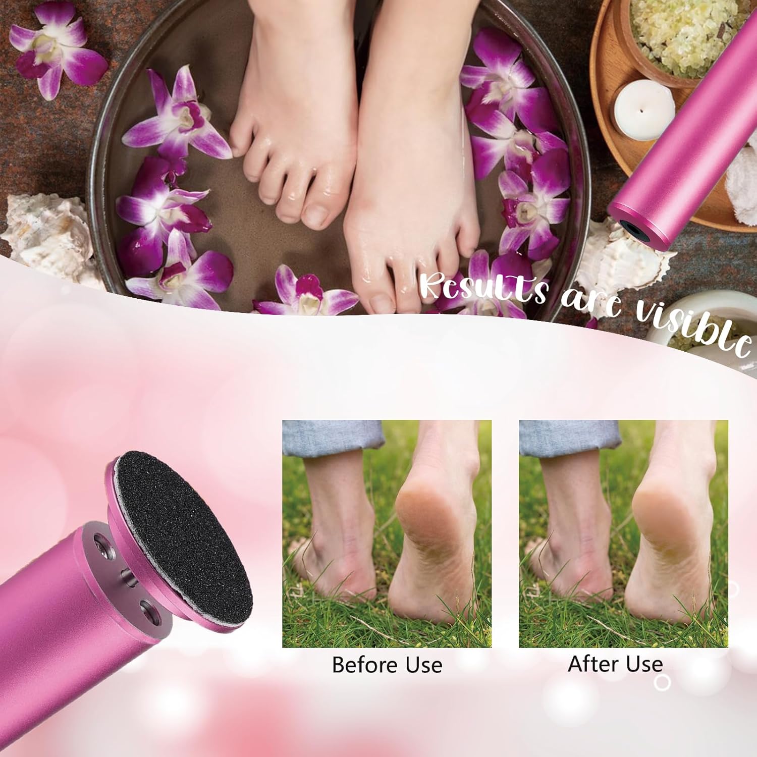 Dermave Upgraded Electric Callus Remover for Feet,Electric Foot File Foot Sander,Adjustable Speed Foot Scrubber,Women Men Dead Skin and Cracked Professional Pedicure Tool,60Pcs Sandpaper Discs - Image 5