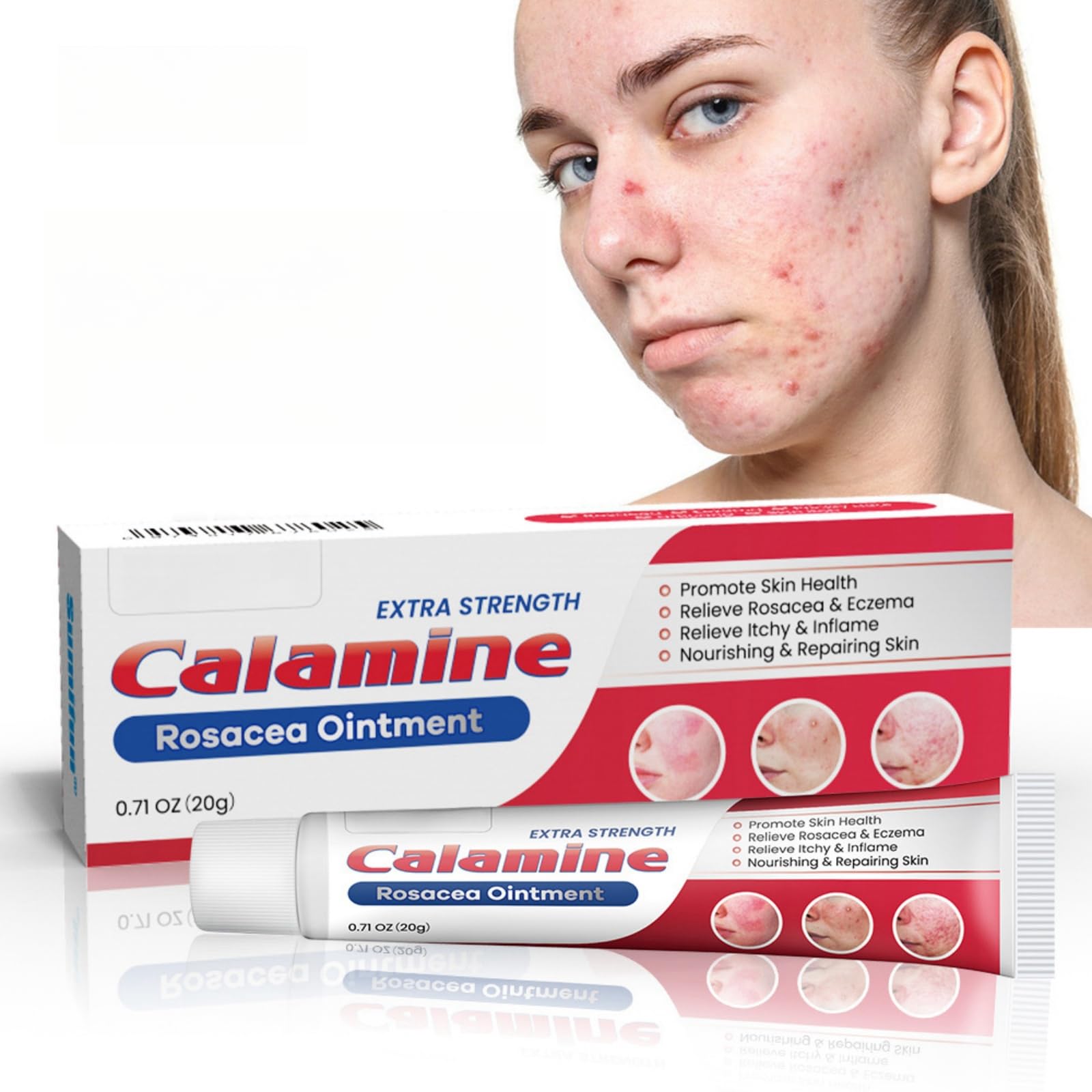 Rosacea Ointment 20g - Promoting Skin Health and Relieving Rosacea & Eczema - Effective Treatment for Itchy and Inflamed Skin - Nourishes & Repairs Damaged Skin - Reduces Redness & Irritation