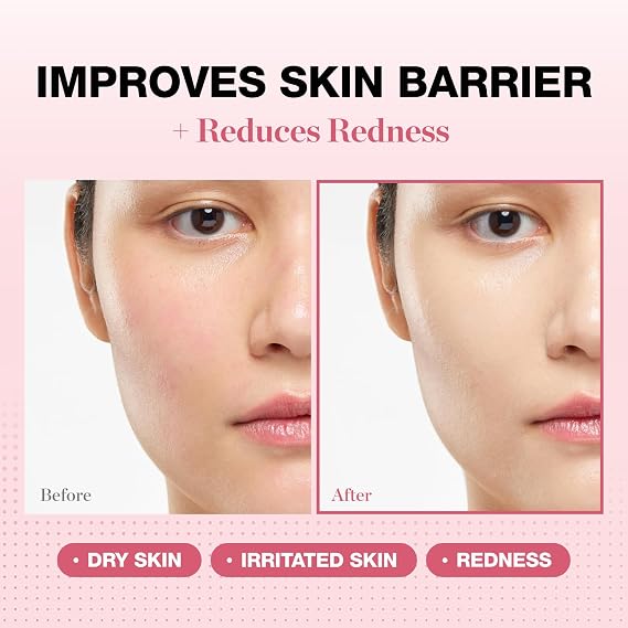 PHYSIOGEL Redness Reducing Cream Ceramide Moisturizer for Dry, Sensitive & Redness-Prone Skin, Repairs Skin Barrier, Dermatologist-Tested, Fragrance-Free, Korean Skincare, 1.69 fl oz