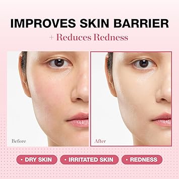PHYSIOGEL Redness Reducing Cream Ceramide Moisturizer for Dry, Sensitive & Redness-Prone Skin, Repairs Skin Barrier, Dermatologist-Tested, Fragrance-Free, Korean Skincare, 1.69 fl oz