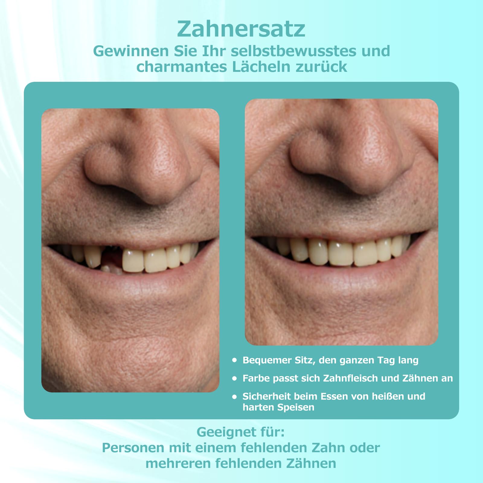 Maßgefertigte Teilprothese für Zahnlücken – Herausnehmbarer Provisorischer Zahnersatz für Frauen Männer, Zahnprothese mit perfektem Sitz. Einfache Anwendung für Ihr perfektes Lächeln zu Hause (1 Zahn)