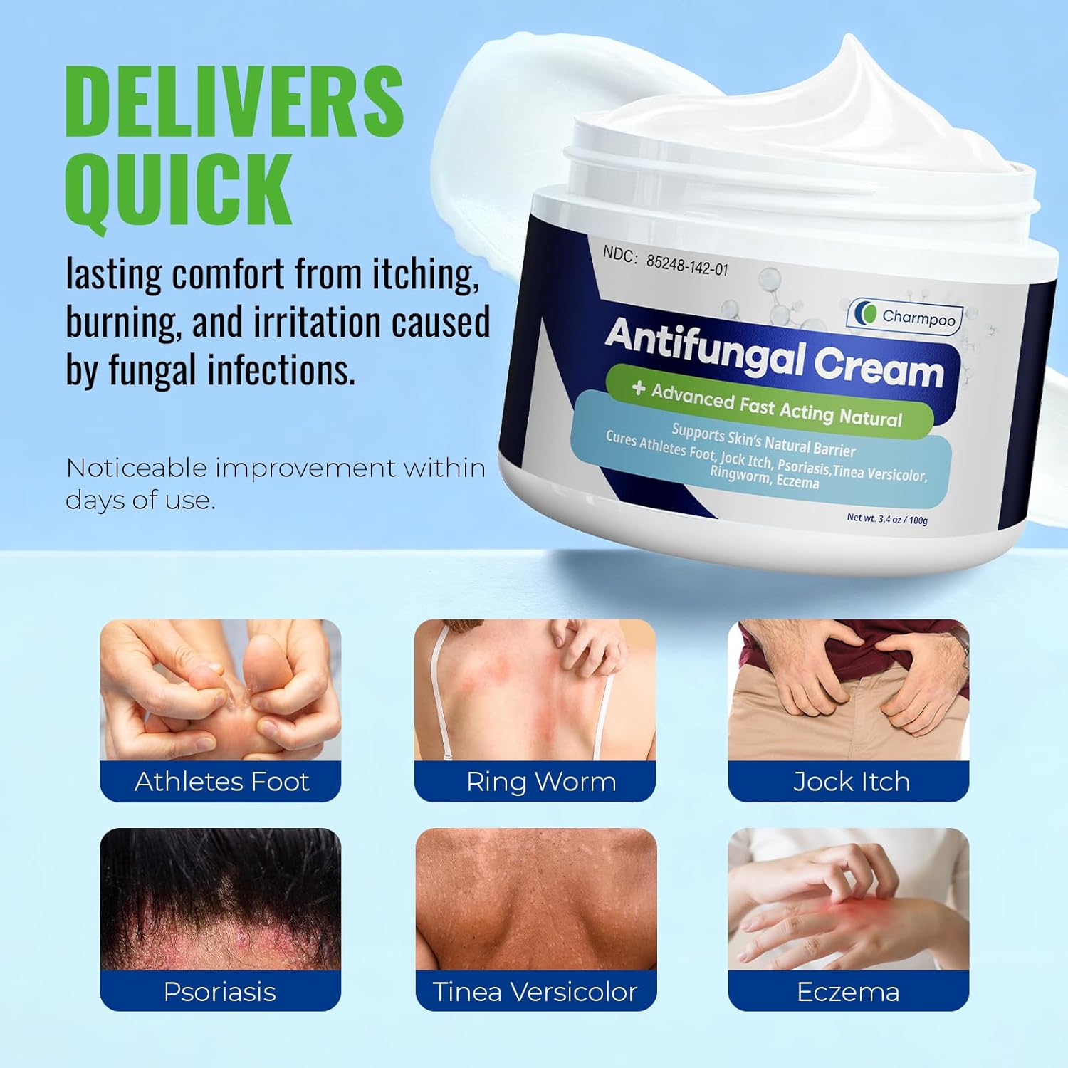 CHARMPOO Antifungal Cream for Jock Itch: 2% Miconazole and Herbal Formula for Itchy Skin Relief Extra Strength - Cures Ringworm Athletes Foot Tinea Versicolor 100g