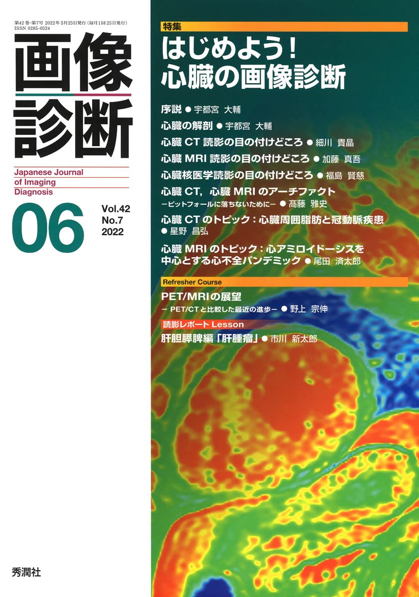 Amazon.co.jp: 画像診断 Vol.42 No.7(2022 6) : 画像診断実行編集委員
