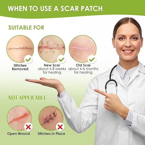 Miniatura 7 de AUSLKA Hojas de silicona para cicatrices (rollo de 1.6 x 120 pulgadas, 9.8 ft), cinta de silicona para cicatrices, tiras de cicatrices, cinta de