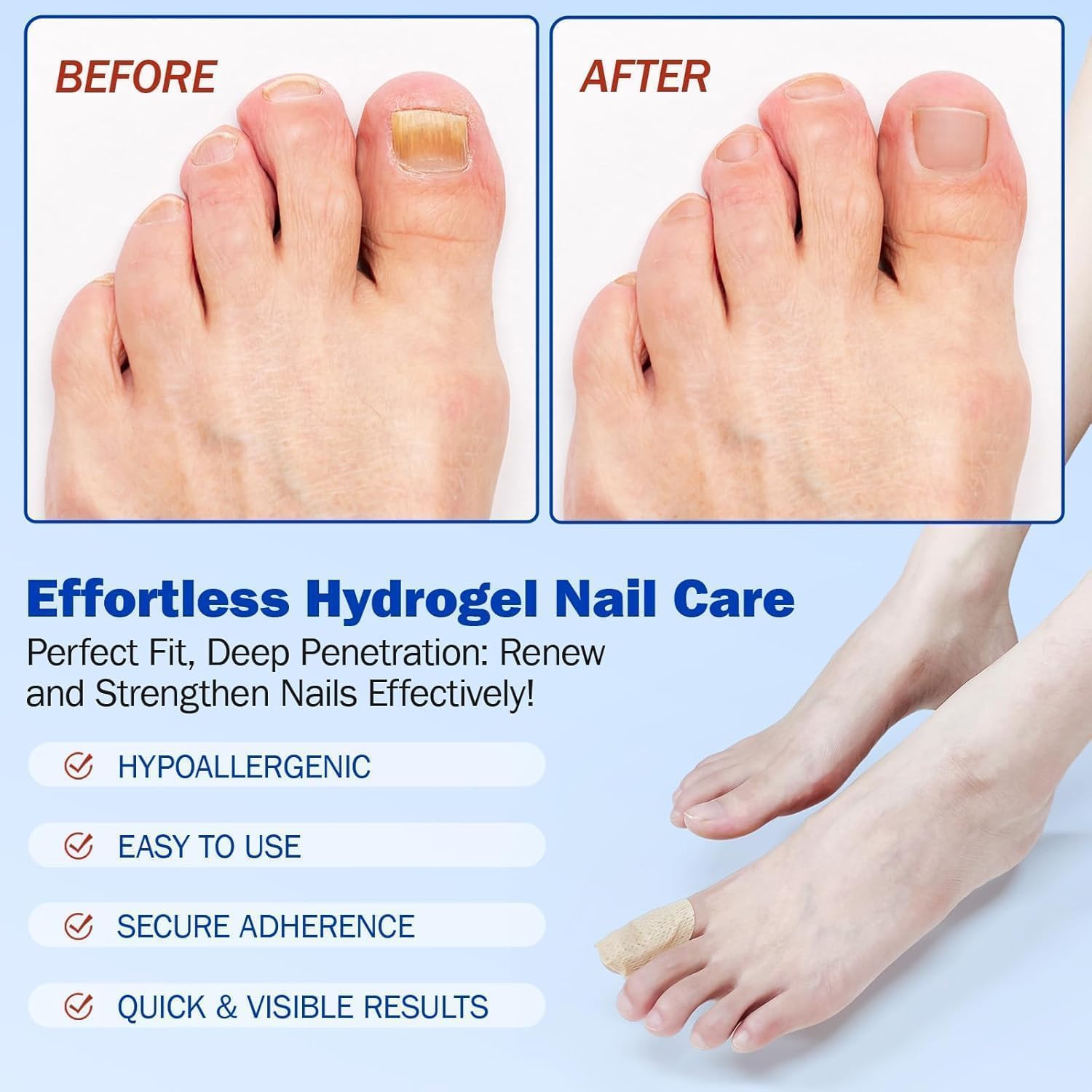 Advanced Fungal Nail Patch Treatment – Powerful Antifungal Solution | Targets Nail Fungus at the Root | Easy-to-Use Patch for Toenail & Fingernail | 20 Patches (40, FREE ALL) - Image 8 thumbnail