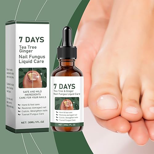 Miniatura 4 de Fungi Nail Liquid 1.0 fl oz - Cuidado de uñas onicomicosis | Ayuda a mejorar las uñas y las uñas decoloradas, agrietadas y engrosadas | Apoya la